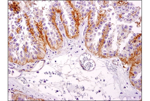 Immunohistochemistry Image 2: EphA2 (D4A2) Rabbit Monoclonal Antibody