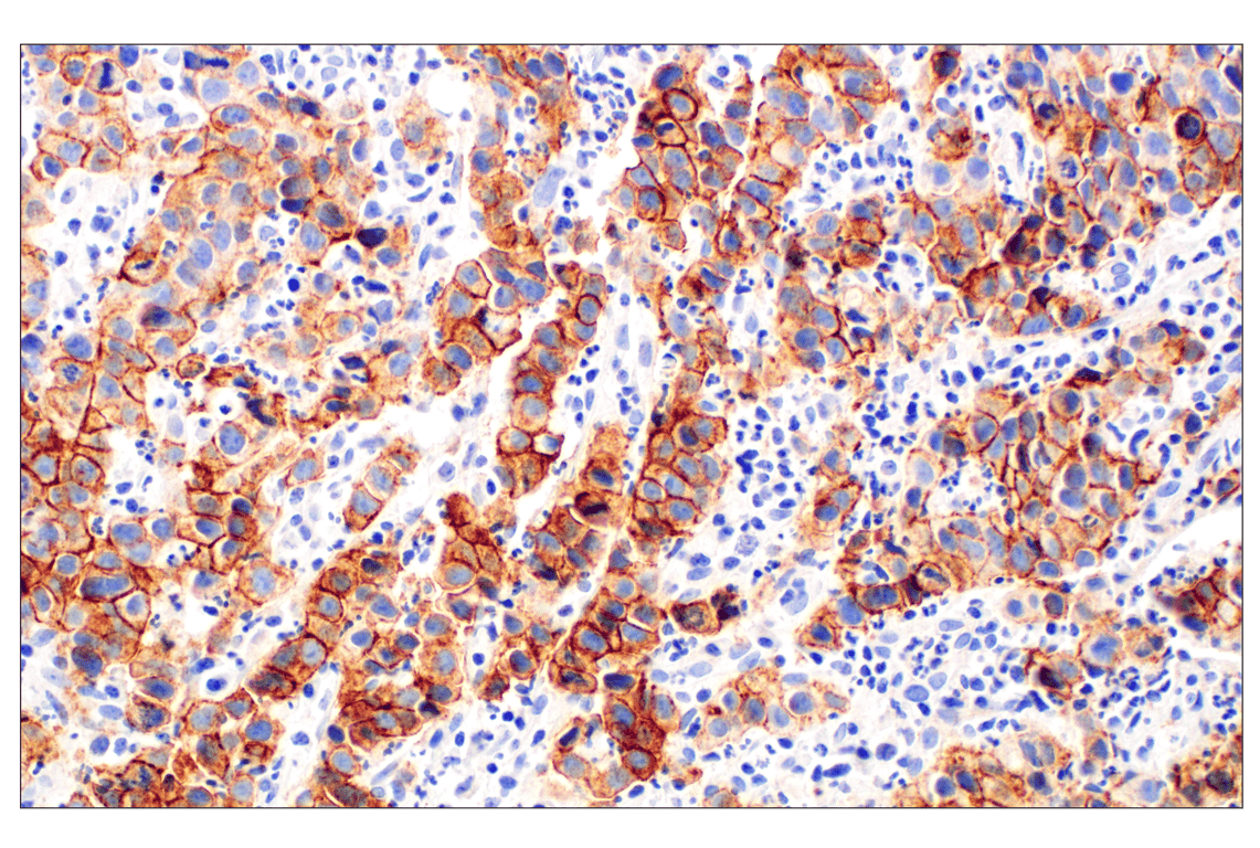 Immunohistochemistry Image 1: FGF Receptor 2IIIb (FPR2-D) Mouse Monoclonal Antibody