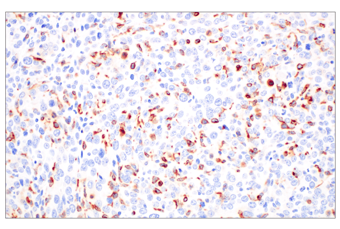 Immunohistochemistry Image 3: CD74 (F3R3L) Rabbit Monoclonal Antibody