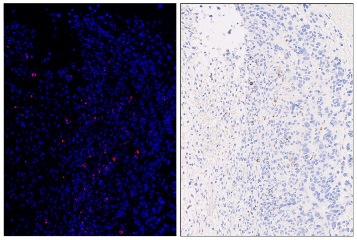 Immunohistochemistry Image 6: Granzyme B (E5V2L) & CO-0049-594 SignalStar<sup>™</sup> Oligo-Antibody Pair