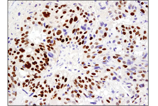 Immunohistochemistry Image 4: SIX1 (D5S2S) Rabbit Monoclonal Antibody