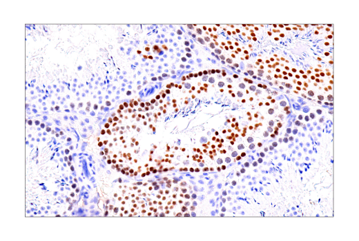 Immunohistochemistry Image 8: ATAD2 (E8Y7F) Rabbit Monoclonal Antibody