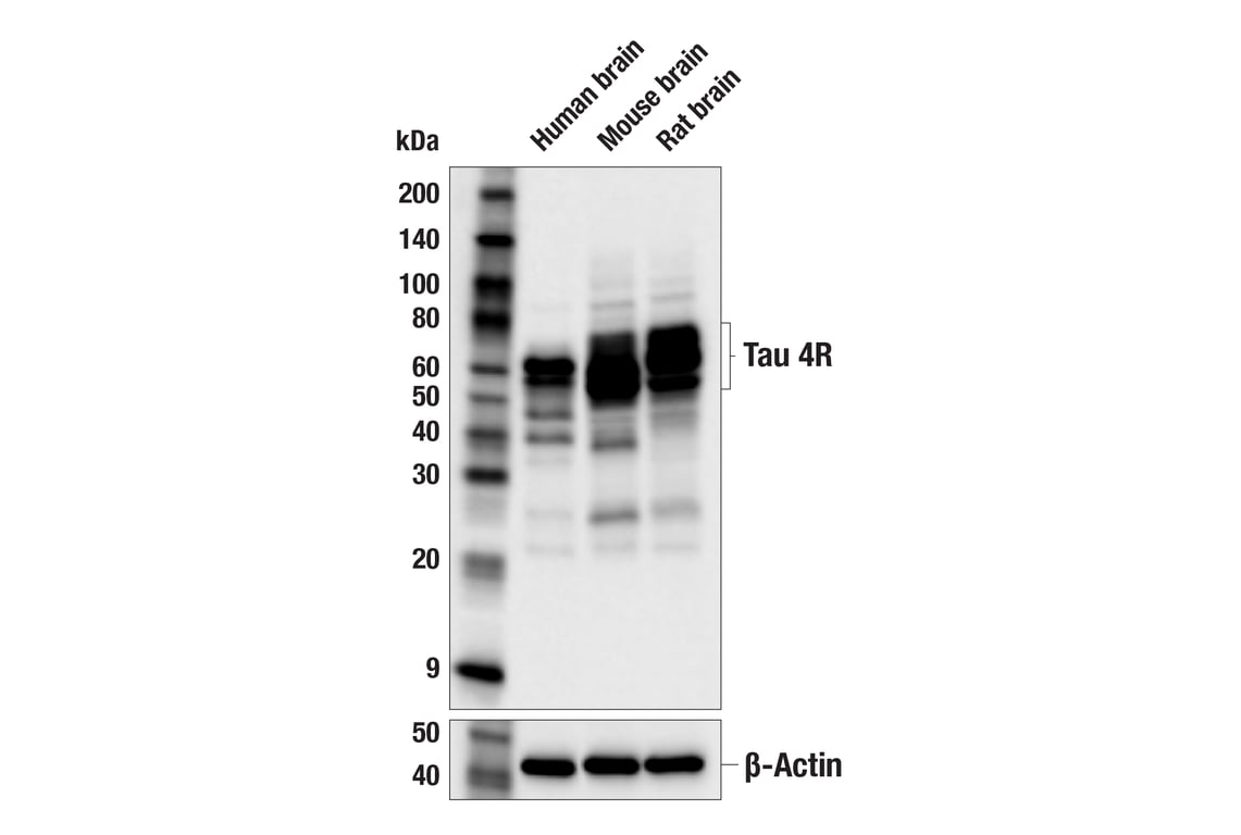 Western Blotting Image 2: Tau 4R (F4O1Y) Mouse Monoclonal Antibody
