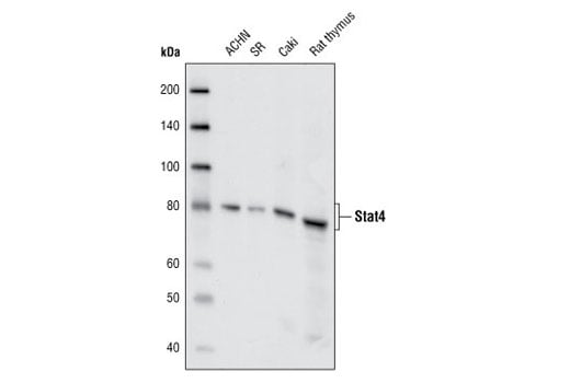 undefined Image 10: Stat Antibody Sampler Kit II