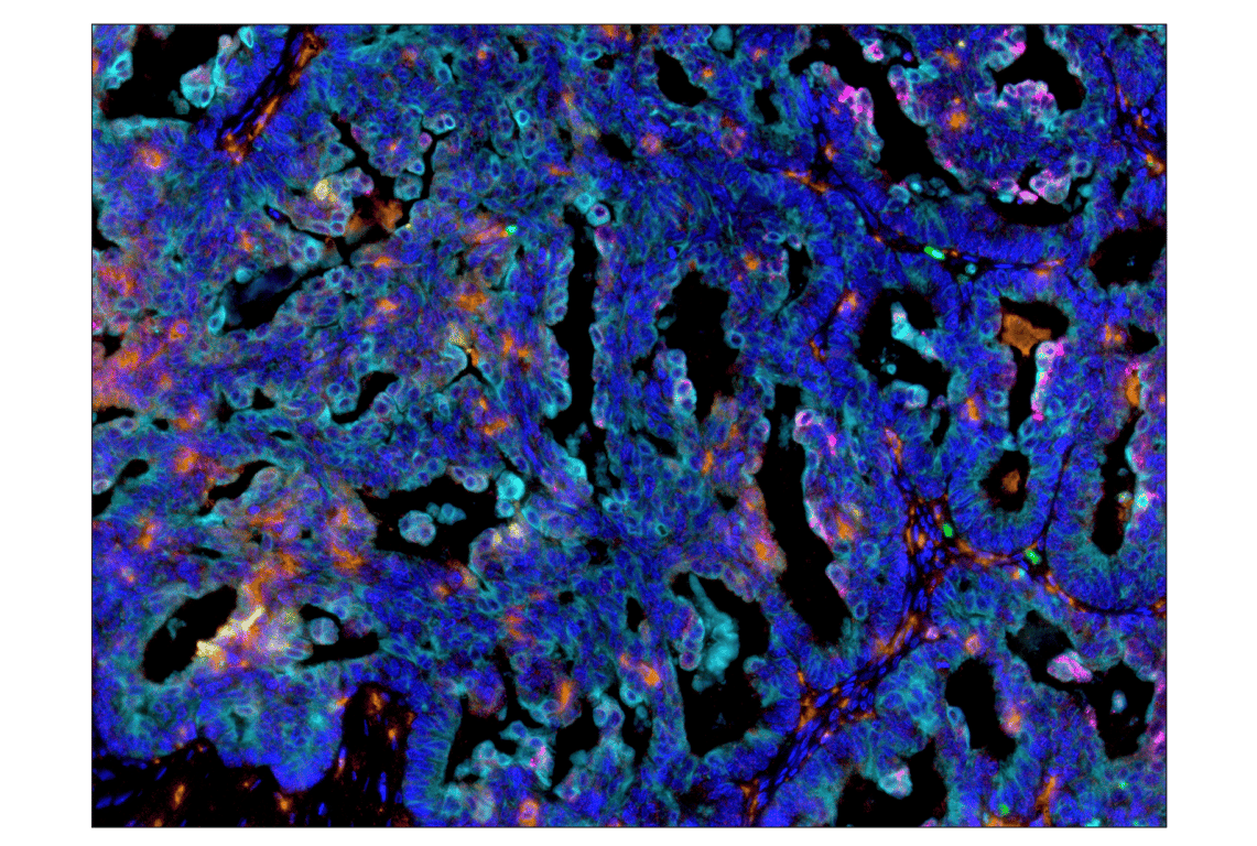 Immunohistochemistry Image 5: PD-L1 (E1L3N) Rabbit Monoclonal Antibody