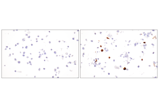 undefined Image 41: NETosis Antibody Sampler Kit