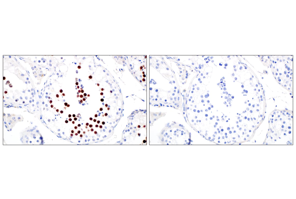 Immunohistochemistry Image 1: SGO2 (E9K4N) Rabbit Monoclonal Antibody (BSA and Azide Free)