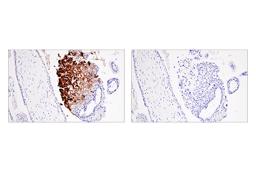 undefined Image 27: MHC Class I Antigen Processing and Presentation Antibody Sampler Kit
