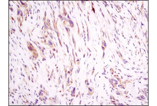 Immunohistochemistry Image 1: Integrin beta1 (D2E5) Rabbit Monoclonal Antibody (BSA and Azide Free)