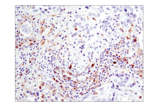 Immunohistochemistry Image 3: Btk (D3H5) Rabbit Monoclonal Antibody (BSA and Azide Free)
