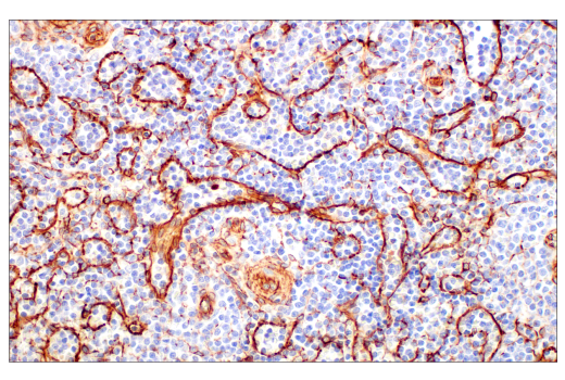 Immunohistochemistry Image 3: Nestin (E4O9E) XP<sup>®</sup> Rabbit mAb