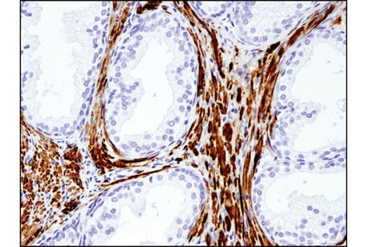 Immunohistochemistry Image 4: UCHL1 (D3T2E) Rabbit Monoclonal Antibody
