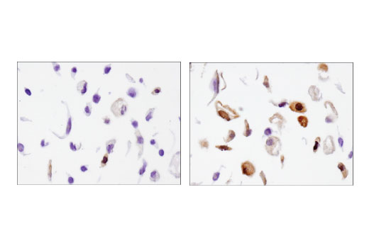 Immunohistochemistry Image 3: beta-Arrestin 1 (D7Z3W) Rabbit Monoclonal Antibody