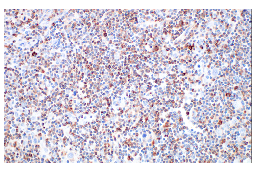 Immunohistochemistry Image 4: Glut3 (E7M7V) Rabbit Monoclonal Antibody