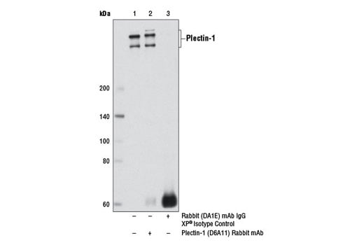 Immunoprecipitation Image 1: Plectin-1 (D6A11) Rabbit Monoclonal Antibody