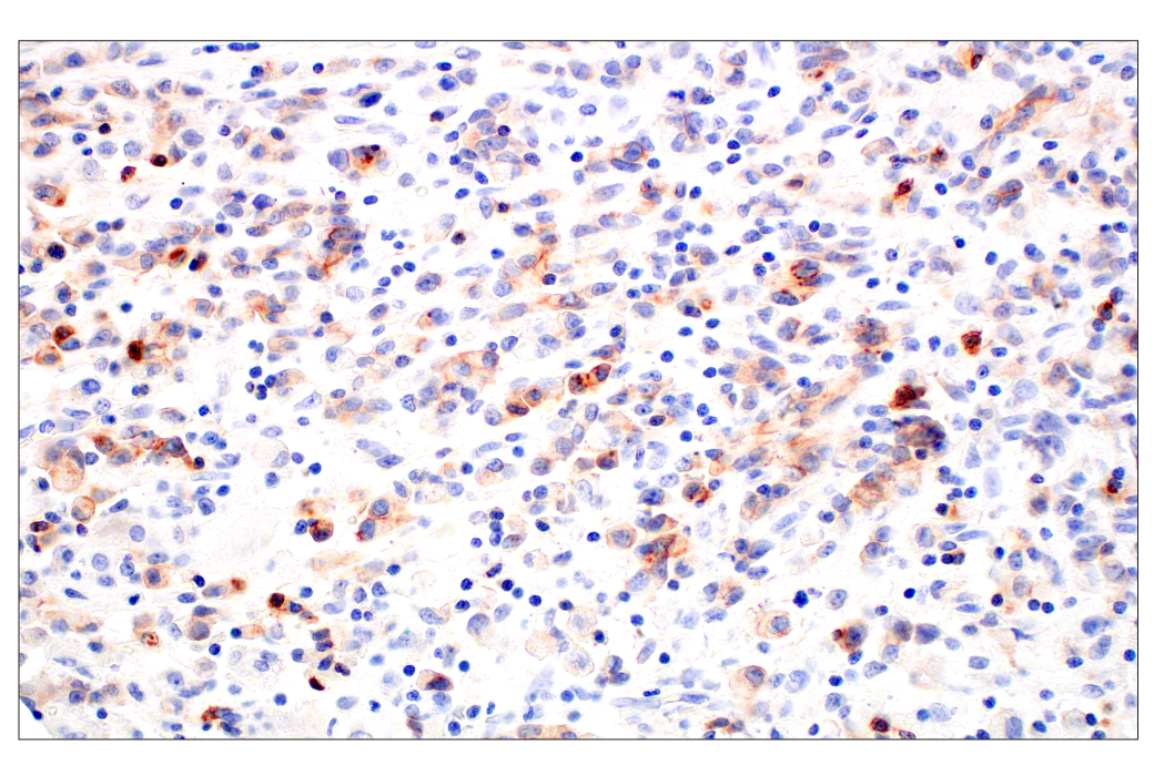 Immunohistochemistry Image 3: CD70 (E3Q1A) Rabbit Monoclonal Antibody