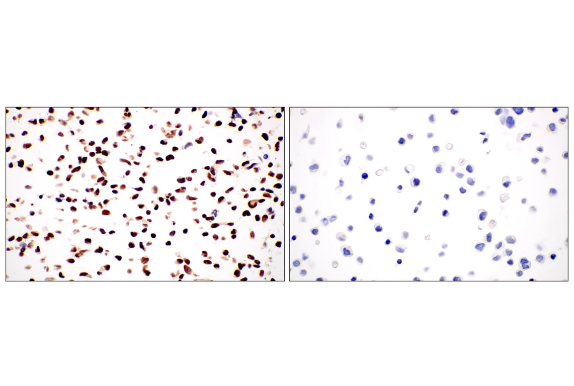 Immunohistochemistry Image 8: TCF12/HEB (E5R8X) Rabbit Monoclonal Antibody