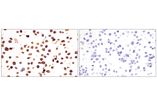 Immunohistochemistry Image 17: FcR gamma (E6Y1A) Rabbit Monoclonal Antibody (BSA and Azide Free)