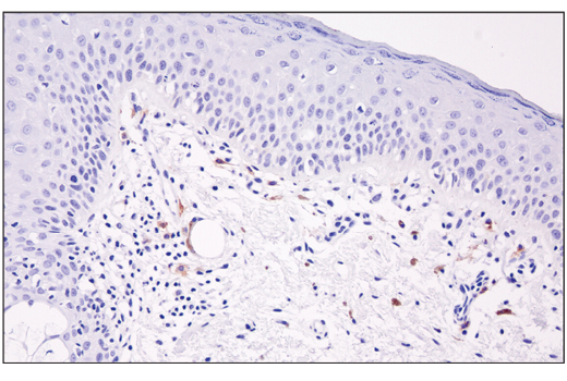 Immunohistochemistry Image 3: XCR1 (D2F8T) Rabbit Monoclonal Antibody