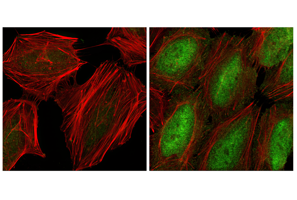 Immunofluorescence Image 1: Phospho-NF-kappaB p65 (Ser536) (93H1) Rabbit Monoclonal Antibody