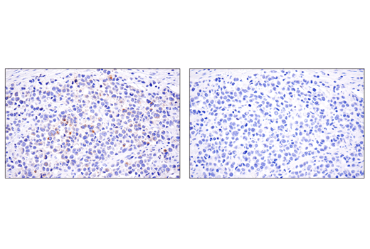 Immunohistochemistry Image 1: 4-1BBL/CD137L/TNFSF9 (E8W3P) Rabbit Monoclonal Antibody