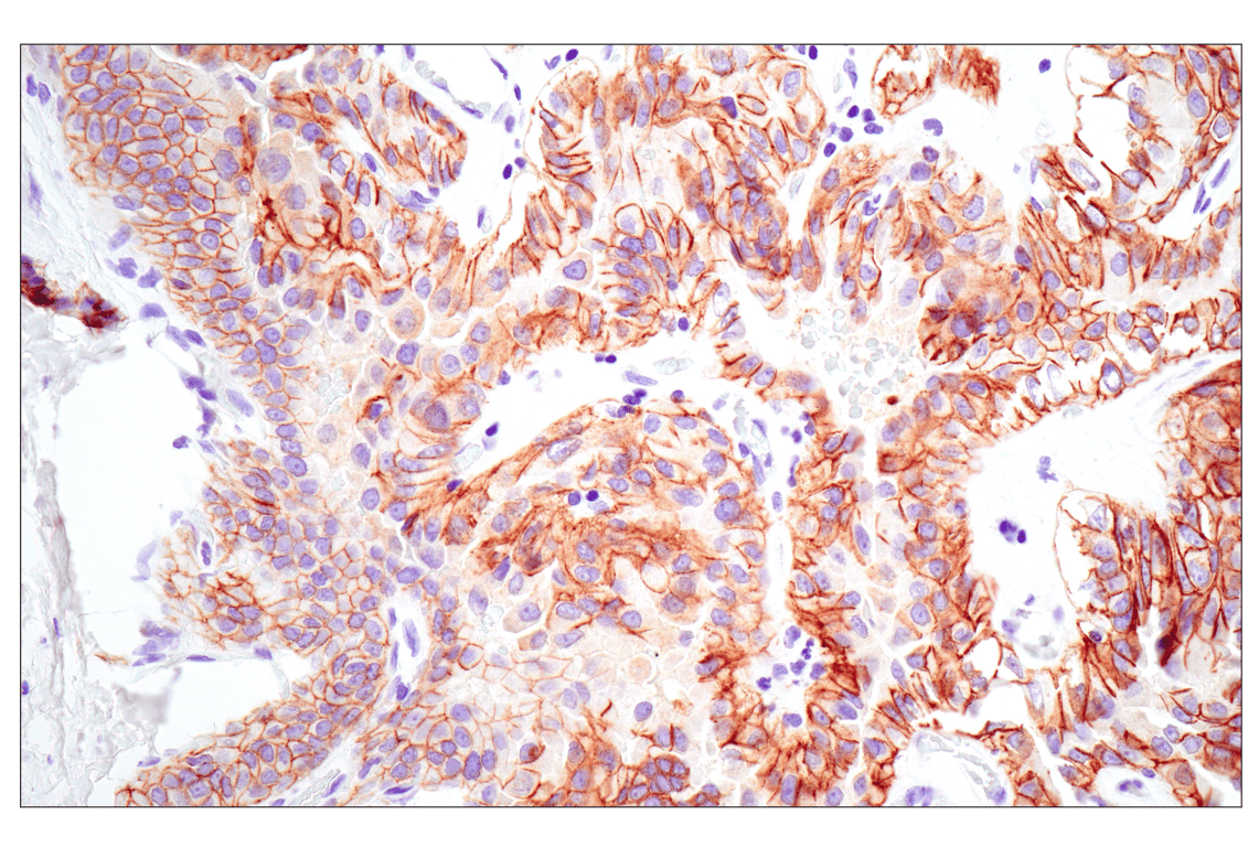 Immunohistochemistry Image 2: E-Cadherin (24E10) Rabbit Monoclonal Antibody (BSA and Azide Free)