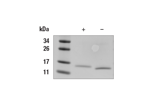 undefined Image 2: Human GM-CSF Recombinant Protein