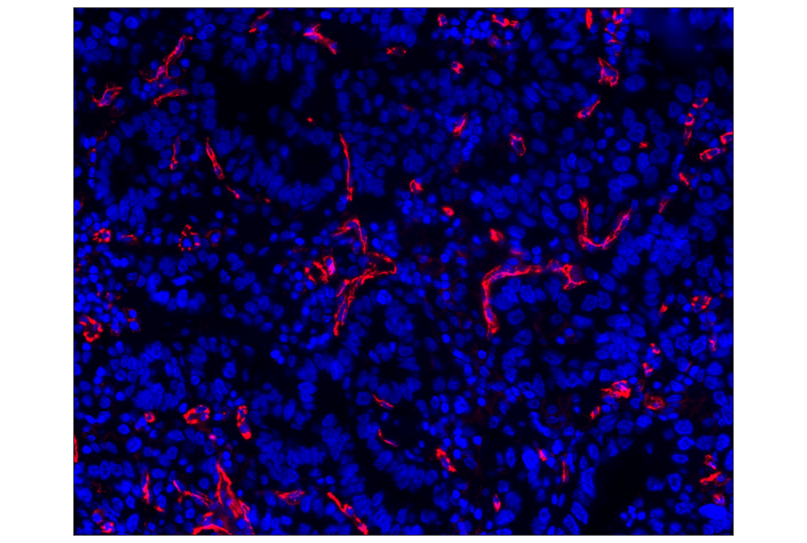 Immunohistochemistry Image 1: CD31 (PECAM-1) (89C2) Mouse mAb (Alexa Fluor<sup>®</sup> 647 Conjugate)