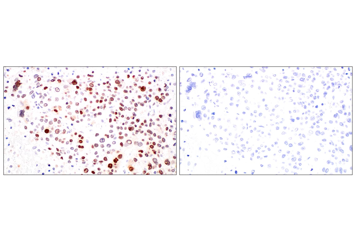 Immunohistochemistry Image 9: POM121 (E3W3J) Rabbit Monoclonal Antibody