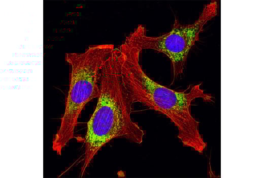 Immunofluorescence Image 1: PDI Antibody