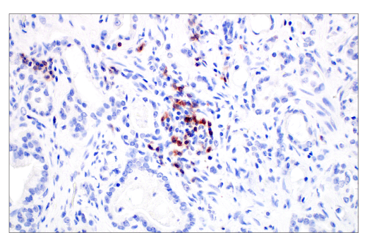 Immunohistochemistry Image 3: TIGIT (E5Y1W) Rabbit Monoclonal Antibody (BSA and Azide Free)