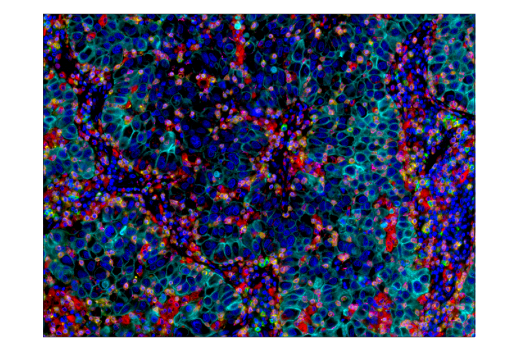 Immunohistochemistry Image 5: TIM-3 (D5D5R<sup>™</sup>) Rabbit Monoclonal Antibody (BSA and Azide Free)