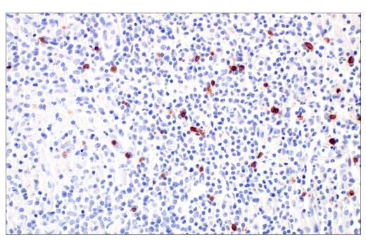 Immunohistochemistry Image 4: TRDC/TCR delta (E2E9T) Rabbit Monoclonal Antibody (BSA and Azide Free)