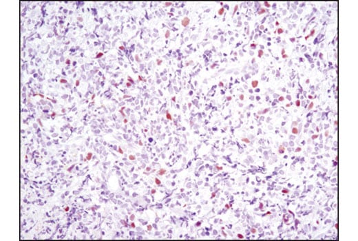 Immunohistochemistry Image 2: Skp2 (D3G5) Rabbit Monoclonal Antibody (BSA and Azide Free)