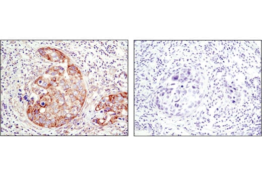 Immunohistochemistry Image 1: YB1 (D299) Antibody