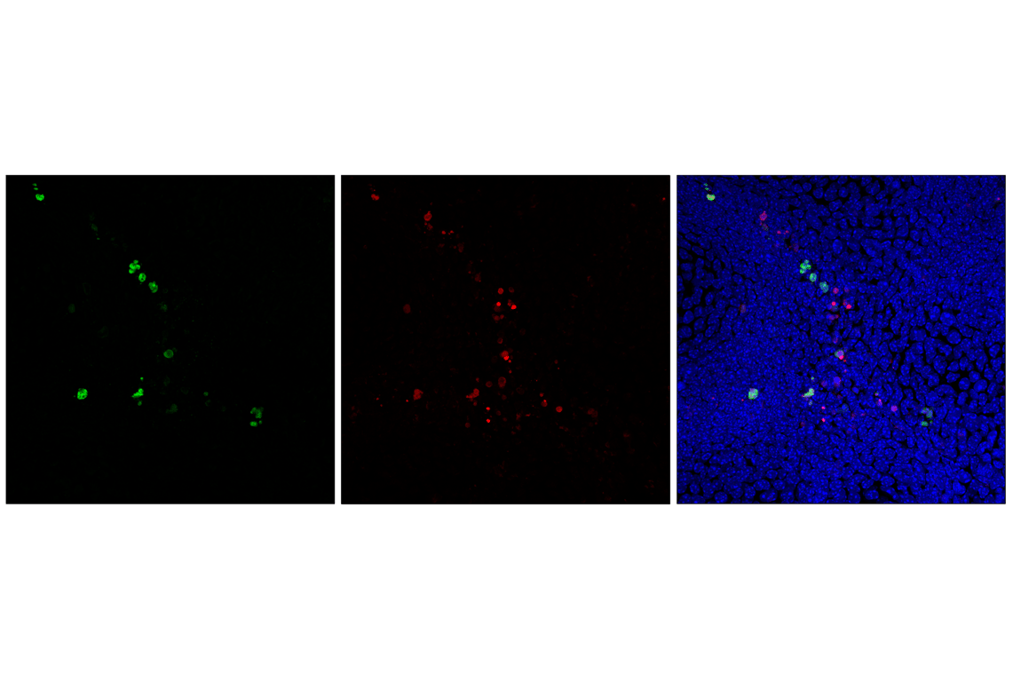 undefined Image 50: beta-Amyloid Mouse Model Neuronal Viability IF Antibody Sampler Kit