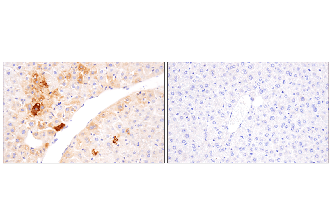 Immunohistochemistry Image 7: APOBEC3A (UMN-13) Rabbit Monoclonal Antibody