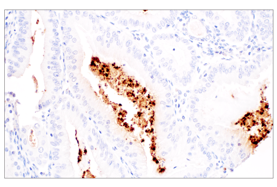 Immunohistochemistry Image 2: Citrullinated Histone H3 (Arg2) (F3C9B) Rabbit Monoclonal Antibody (BSA and Azide Free)