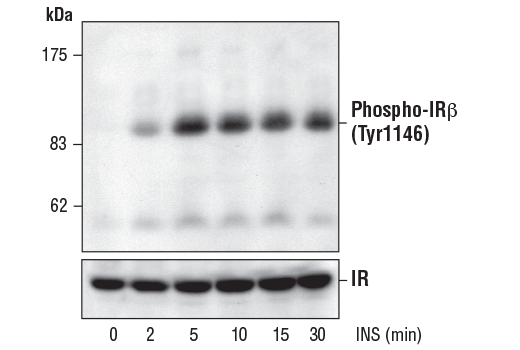 undefined Image 1: Phospho-Insulin/IGF Receptor Antibody Sampler Kit