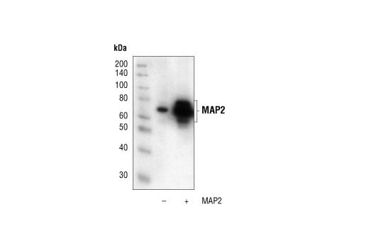 Western Blotting Image 2: MAP2 Antibody