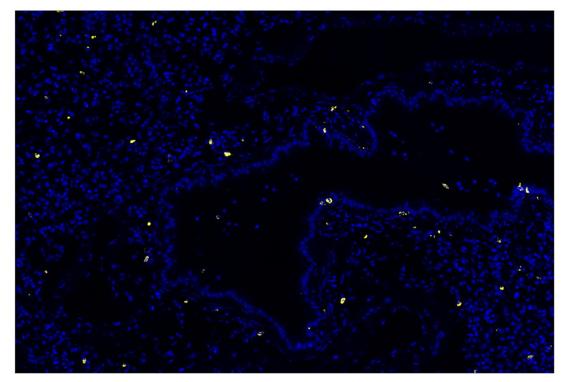 Immunohistochemistry Image 1: Neutrophil Elastase (E8U3X) & CO-0137-647 SignalStar<sup>™</sup> Oligo-Antibody Pair