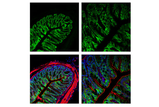 Immunofluorescence Image 3: AQP4 (D1F8E) Rabbit Monoclonal Antibody (BSA and Azide Free)