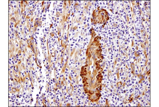 Immunohistochemistry Image 1: Vinculin (E1E9V) Rabbit Monoclonal Antibody