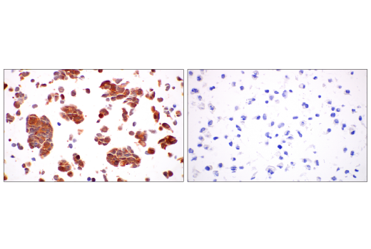 undefined Image 19: Cancer-associated Growth Factor Antibody Sampler Kit