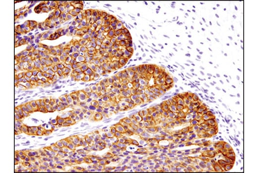 Immunohistochemistry Image 1: Keratin 17/19 (D4G2) Rabbit Monoclonal Antibody