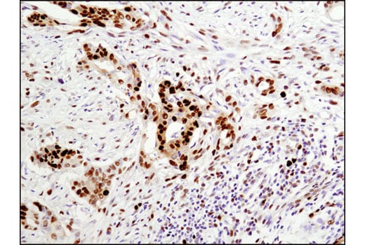 Immunohistochemistry Image 2: PCNA (D3H8P) Rabbit Monoclonal Antibody