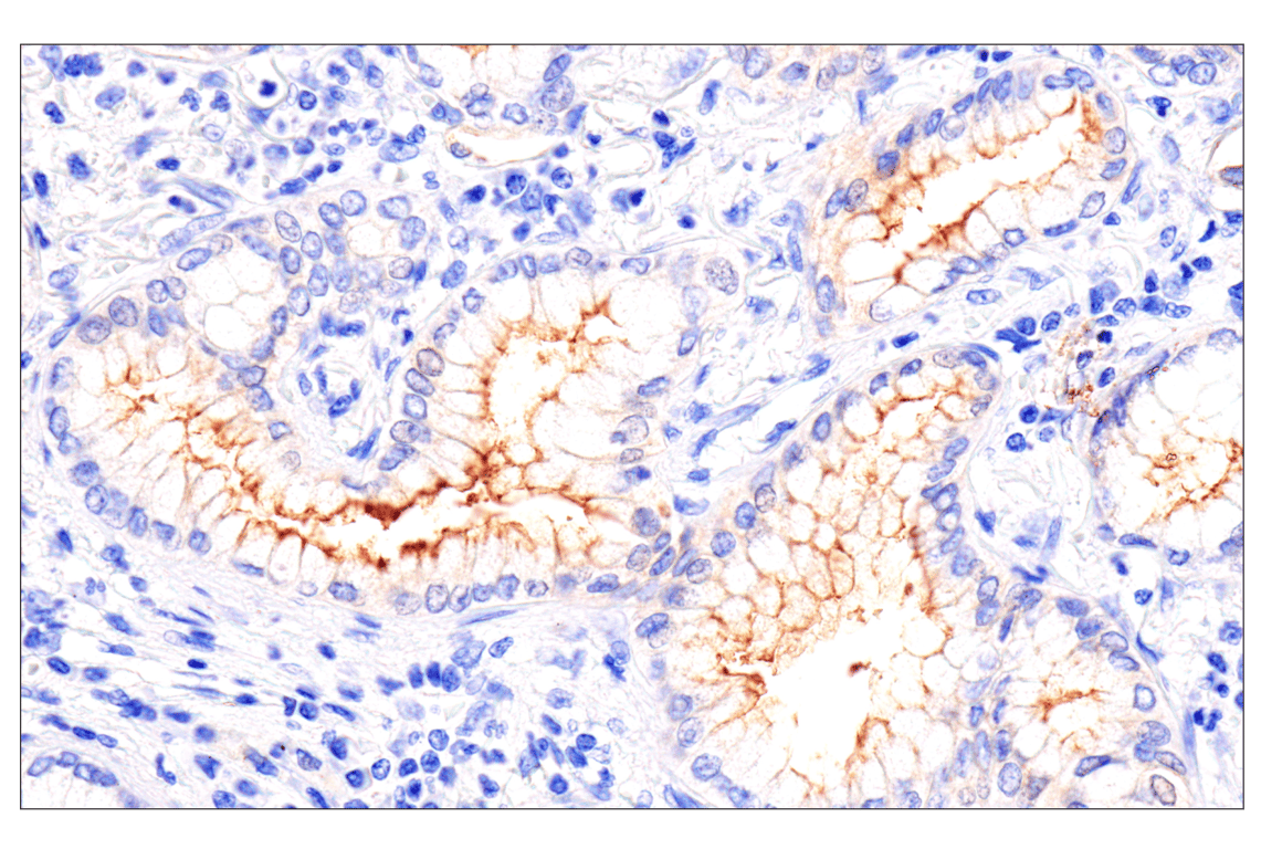 Immunohistochemistry Image 3: Folate Receptor Alpha/FOLR1 (BN3.2) Mouse Monoclonal Antibody