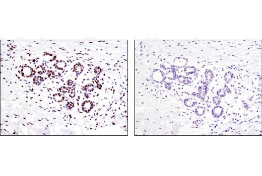 Immunohistochemistry Image 1: Acetyl-Histone H4 (Lys5) (D12B3) Rabbit Monoclonal Antibody