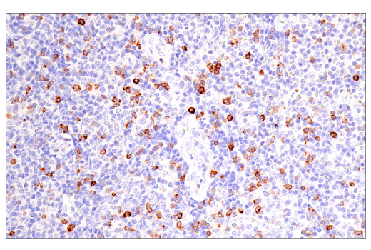 Immunohistochemistry Image 1: CD7 (LP15) Mouse mAb