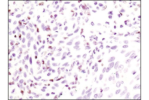 Immunohistochemistry Image 3: Phospho-Stat5 (Tyr694) (C71E5) Rabbit Monoclonal Antibody (BSA and Azide Free)